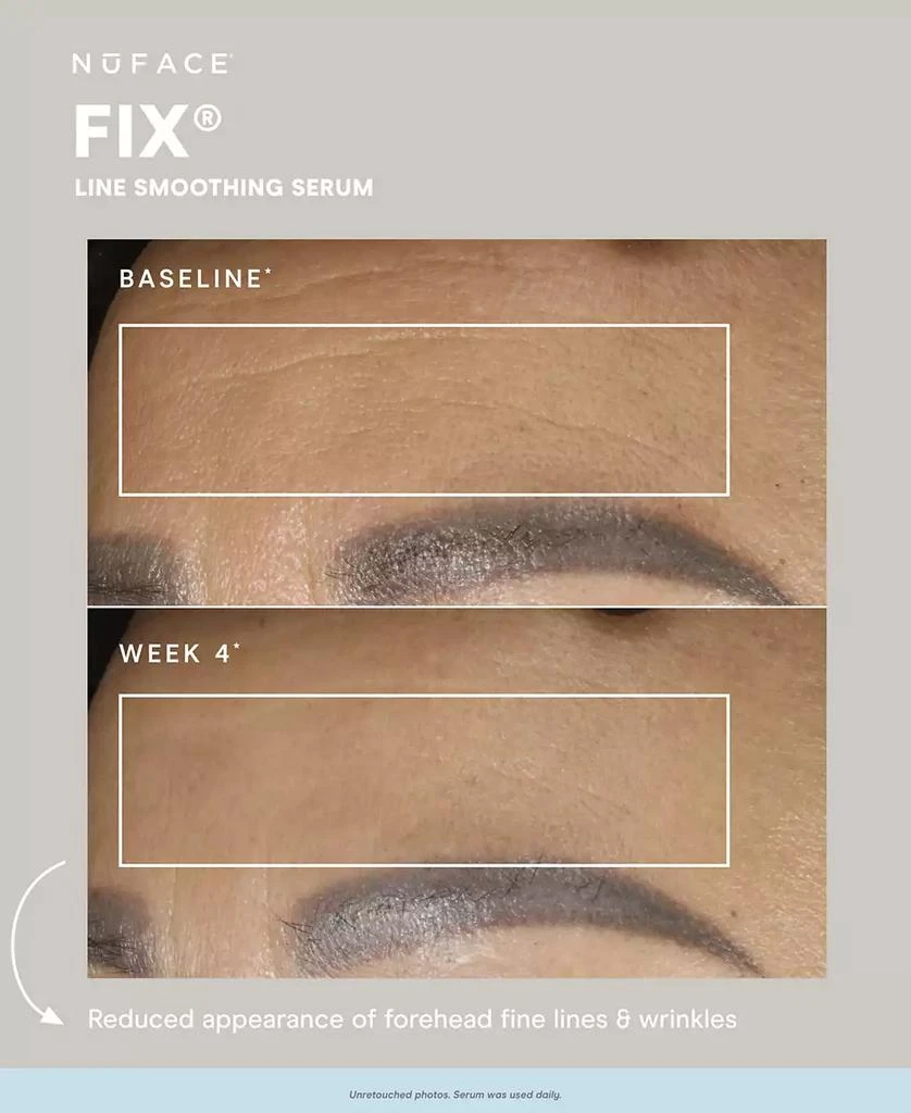 NuFace FIX® Serum, .5 oz. 2