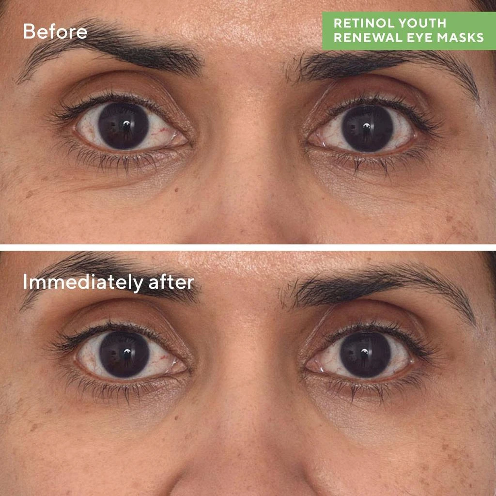 Murad Murad Retinol Youth Renewal Eye Masks 3