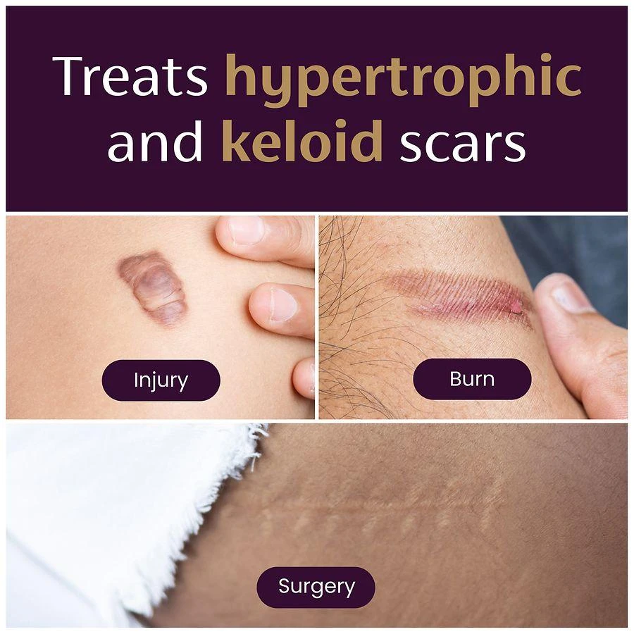 Mederma Medical Grade Silicone Scar Sheets, Improves Appearance of Old & New Scars Small 4