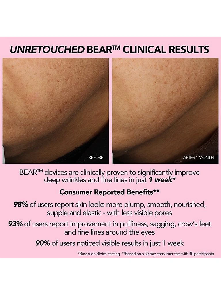 Foreo BEAR Smart Microcurrent Facial Toning Device 8