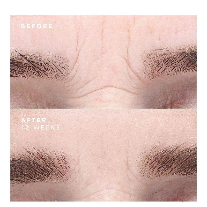 Bio Effect EGF Serum 2