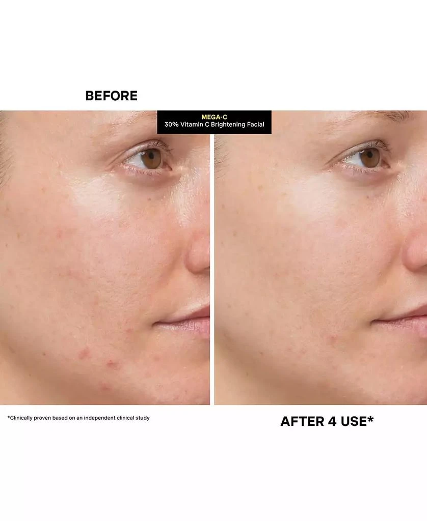 Kate Somerville Mega-C 30% Vitamin C Brightening Facial, 2 oz. 9