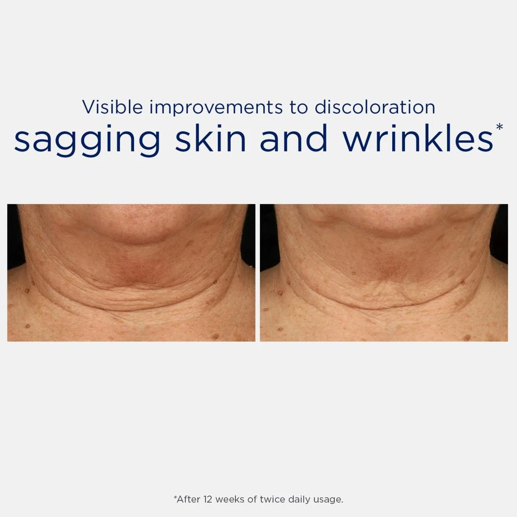 NeoStrata Neostrata Skin Active Triple Firming Neck Cream New and Improved Formula with MicroDiPeptide229 80g 5