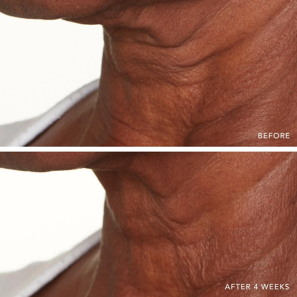 Lancer Skincare Lancer Skincare Active Rejuvenation Serum with Triple Dermal Complex 8