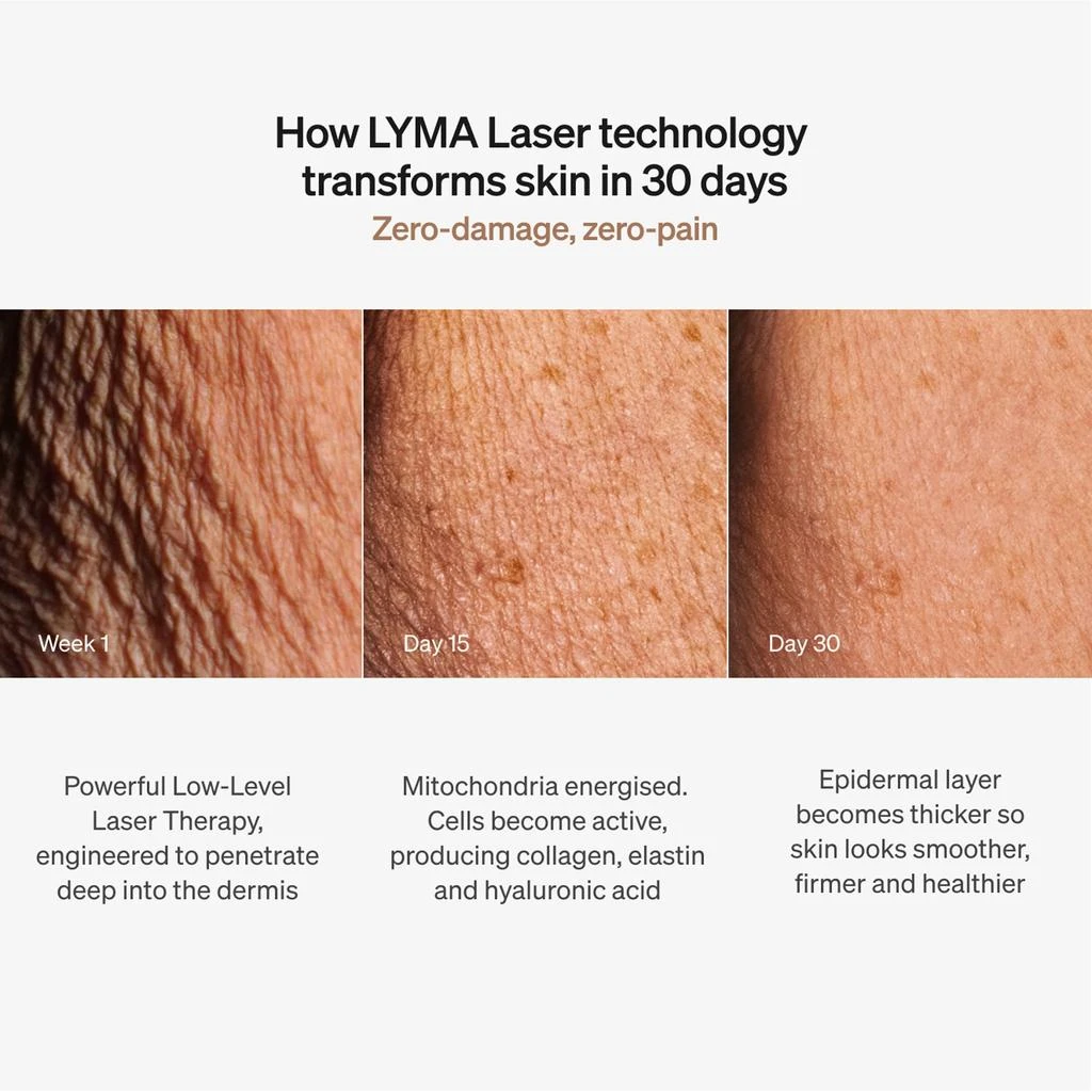LYMA LYMA Laser Starter Kit 7