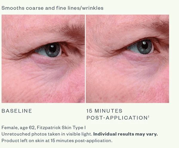 SkinMedica SkinMedica Instant Bright Eye Cream 14.2g 4