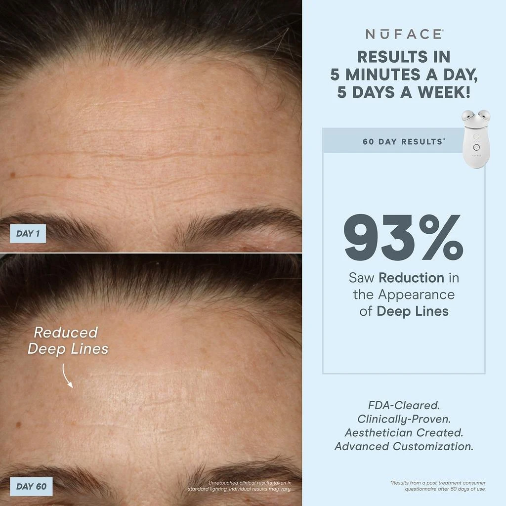 NuFace NuFACE Trinity+ Red Light and Wrinkle Reducer Attachment Set 8