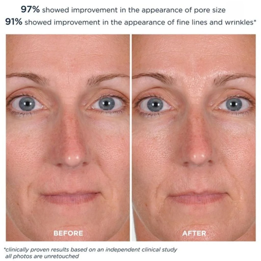 M-61 PowerGlow Peel 9
