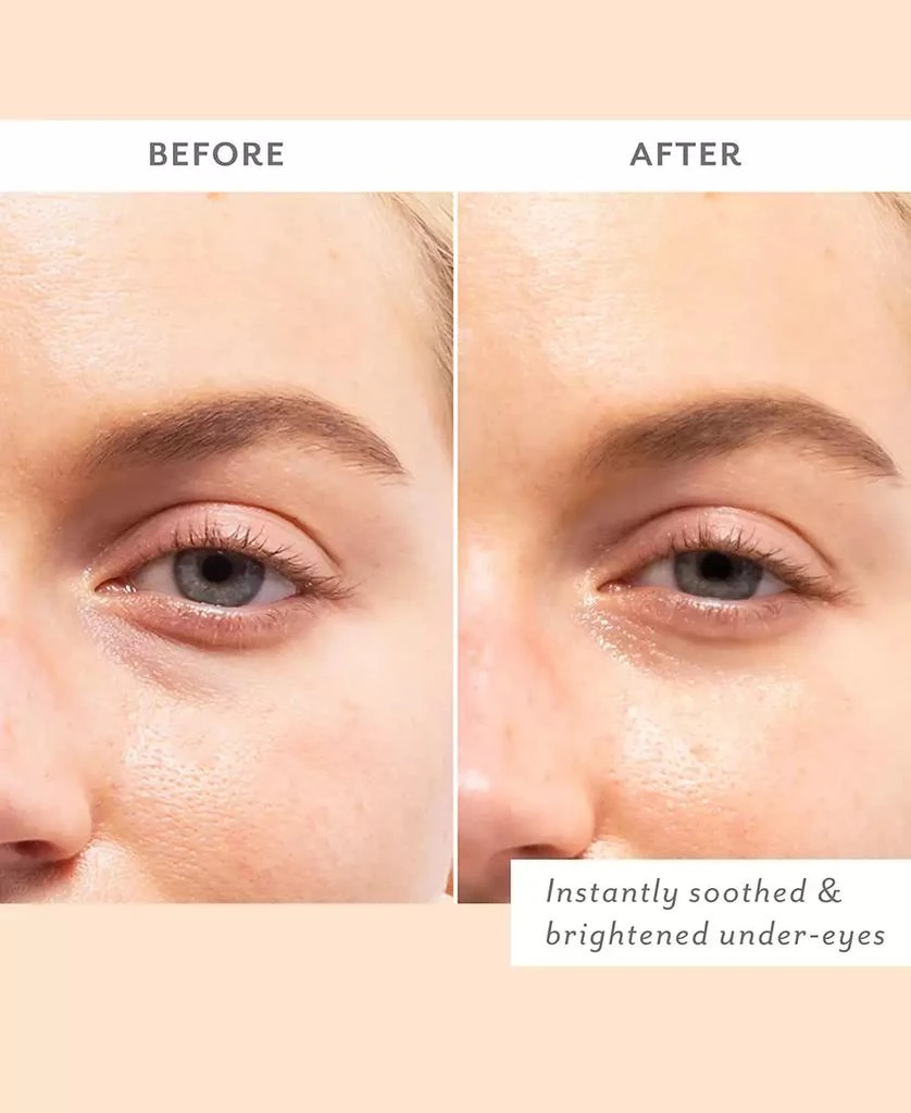 Patchology Skin Remedy Soothing Eye Gels 3
