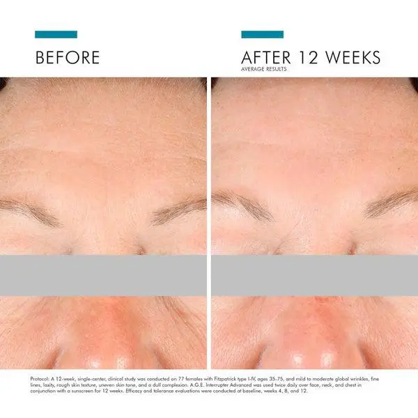 SkinCeuticals SkinCeuticals A.G.E. Interrupter Advanced Anti-Wrinkle Cream (1.7 fl. oz.) 5