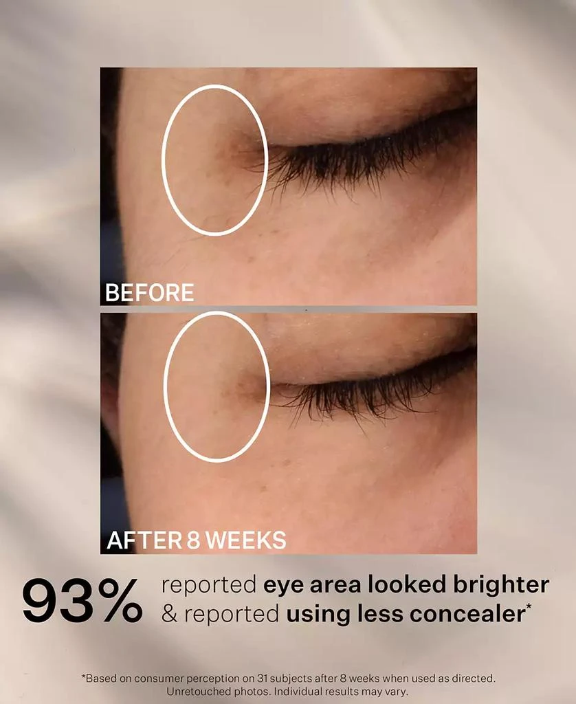 StriVectin Super-C Dark Circle Brightening Eye Serum 7