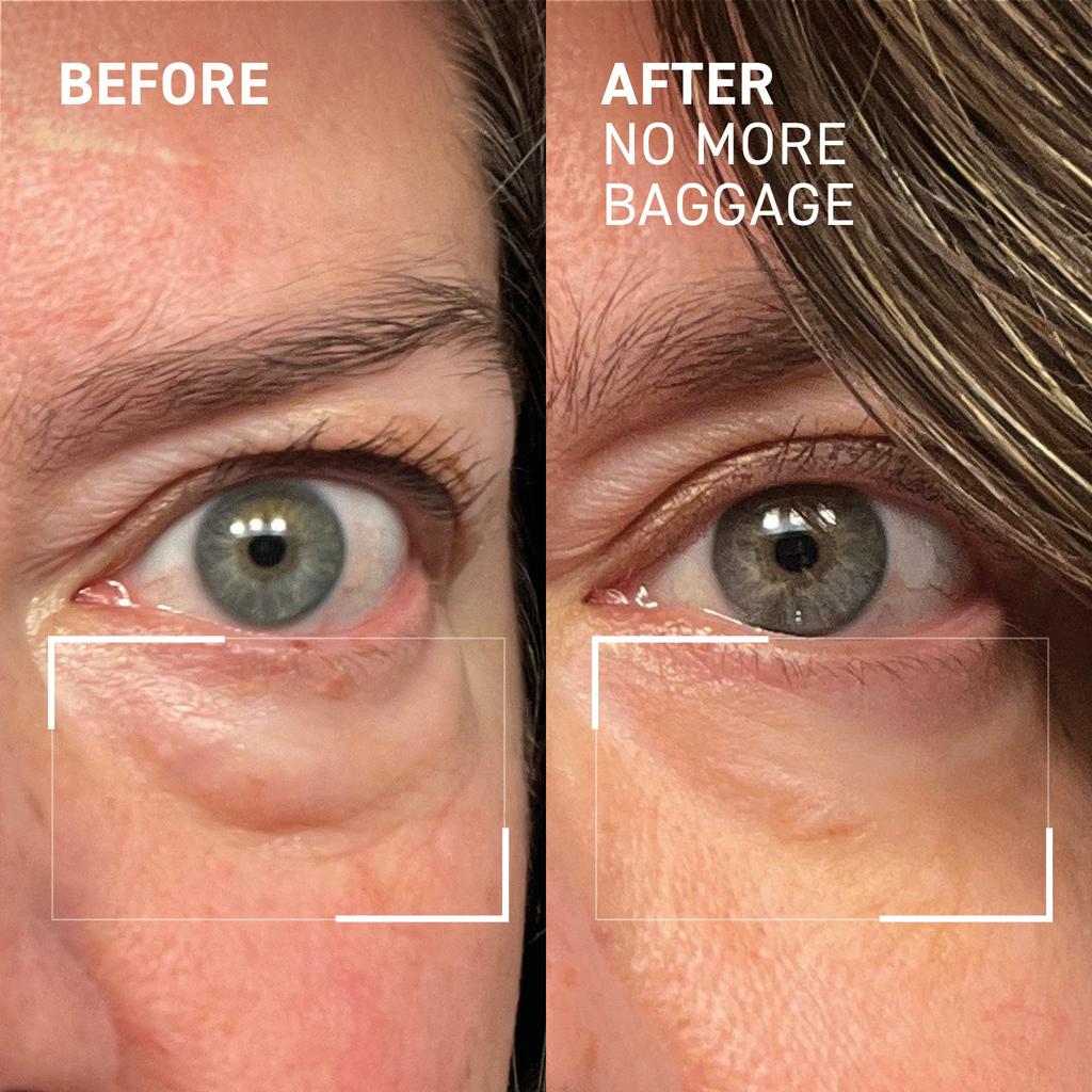 Dr. Brandt Skincare NO MORE BAGGAGE