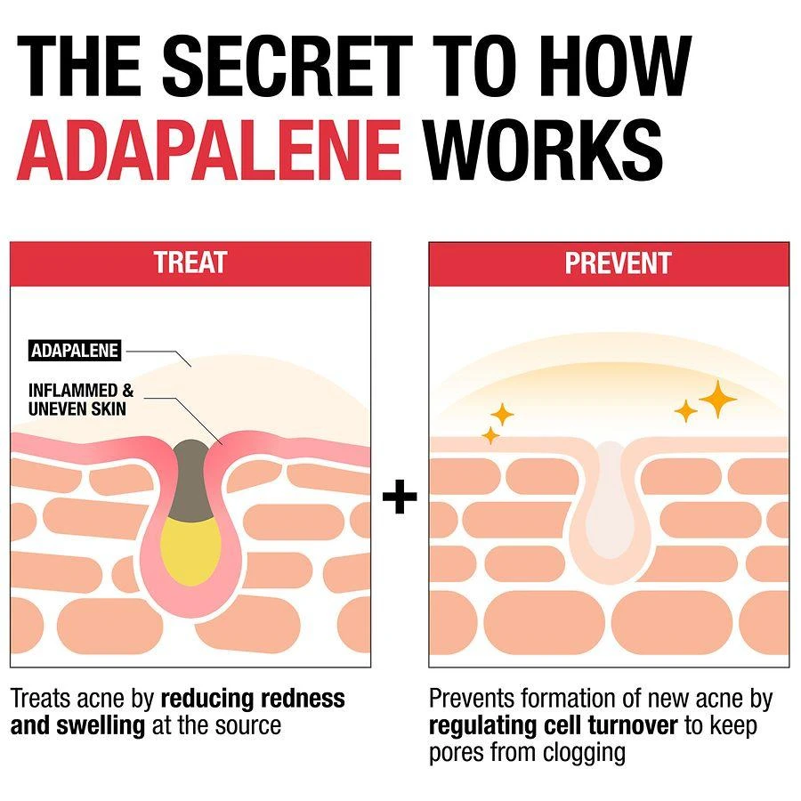 Neutrogena Adapalene Gel Acne Treatment Fragrance Free 10
