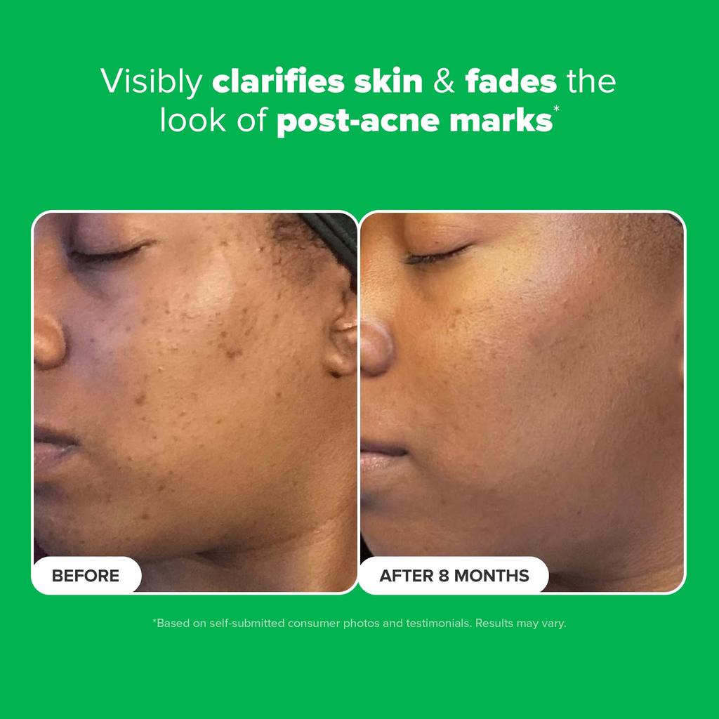 Paula's Choice Paula's Choice 10 Azelaic Acid Booster
