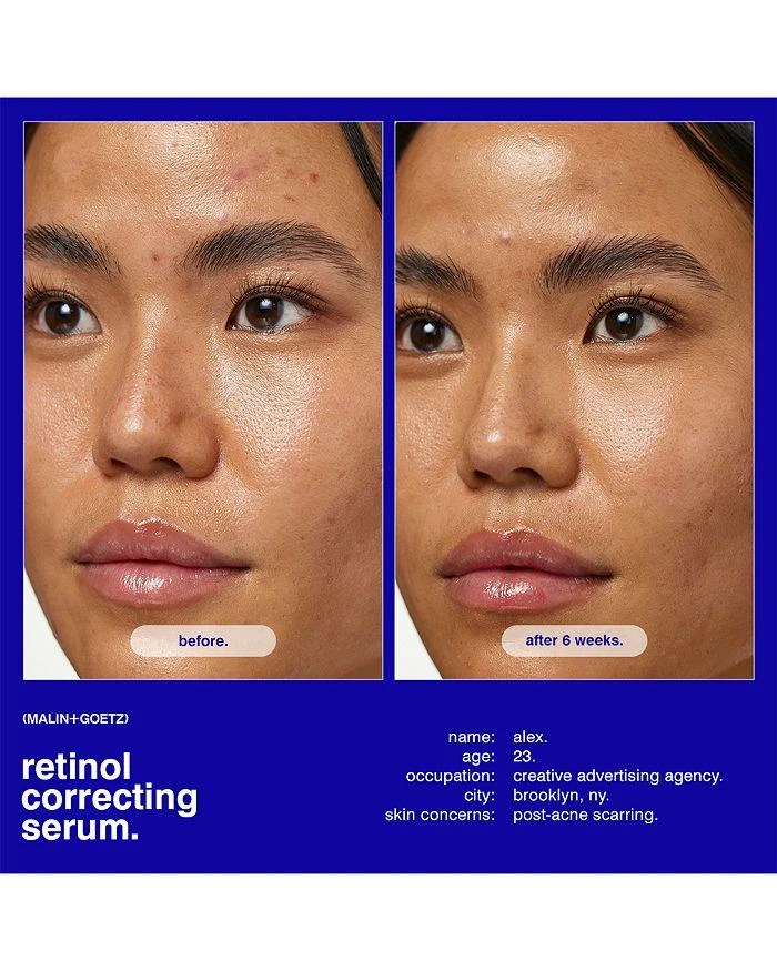 Malin + Goetz Retinol Correcting Serum 1 oz. 5