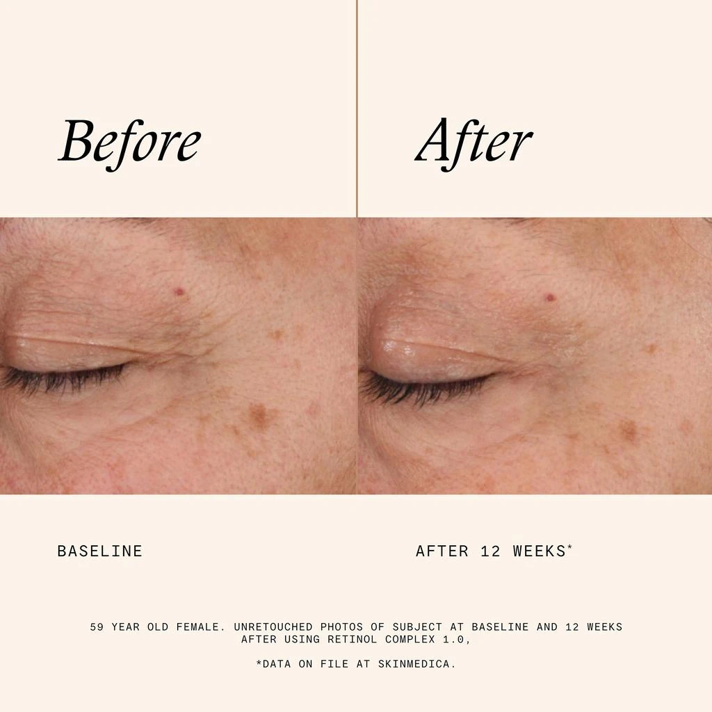 SkinMedica SkinMedica Age Defense Retinol Complex 0.5 4