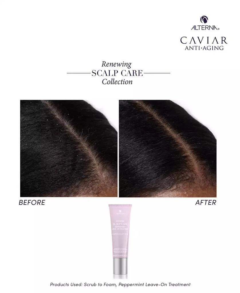 ALTERNA Renewing Scalp Care Peppermint Leave-On Treatment, 2.5 oz. 4