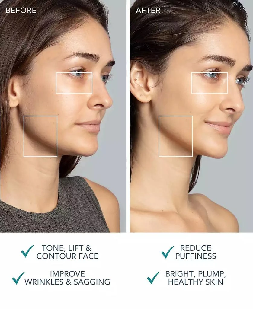 Foreo BEAR 2 Advanced Microcurrent Facial Toning Device 7