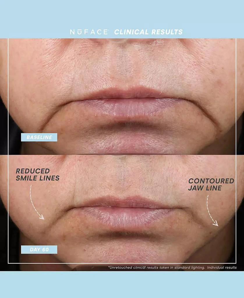 NuFace 6-Pc. Trinity+ Complete Toning Set 4
