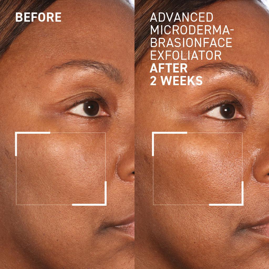 Dr. Brandt Skincare Advanced Face Exfoliator