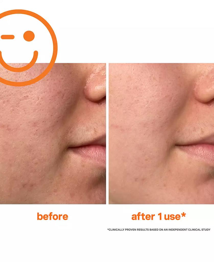 Kate Somerville ExfoliKate Intensive Exfoliating Treatment, 2 oz.