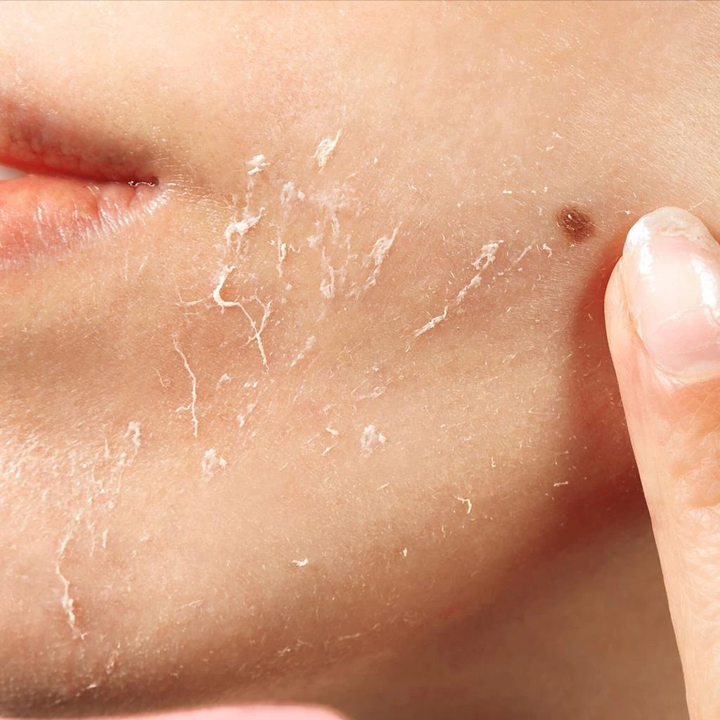 Odacite Bioactive Rose  Gommage 3