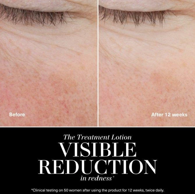 La Mer The Treatment Lotion 4