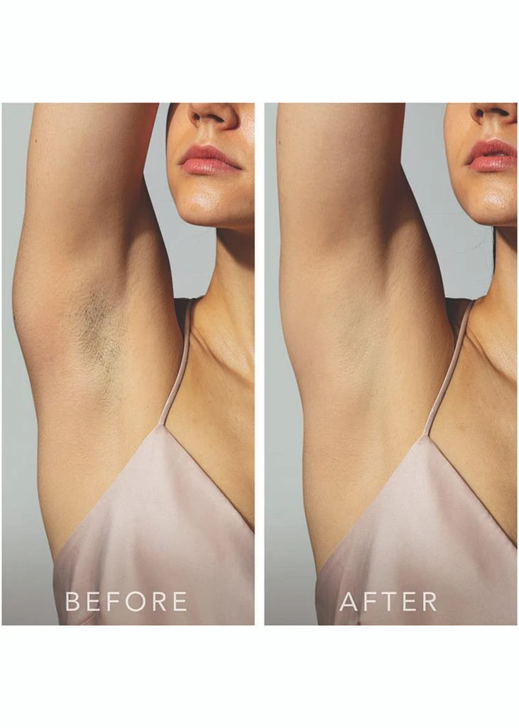 Foreo PEACH 2 Advanced IPL hair removal device 4