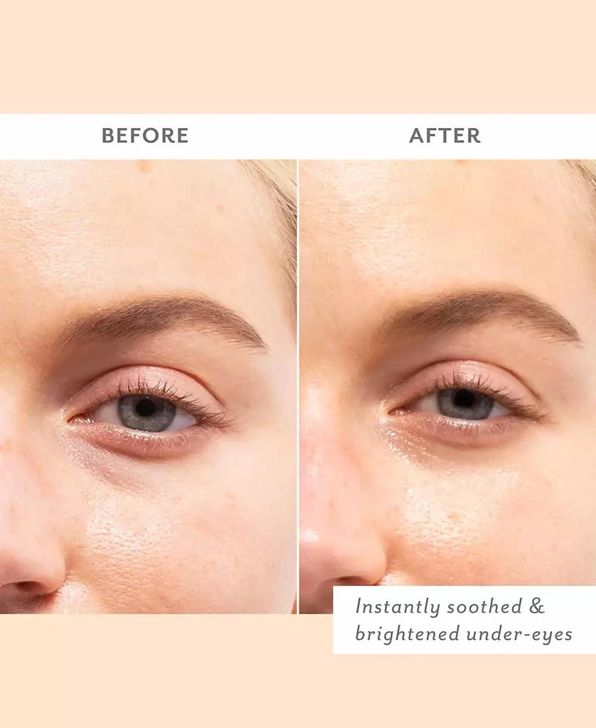 Patchology Skin Remedy Soothing Eye Gels 8