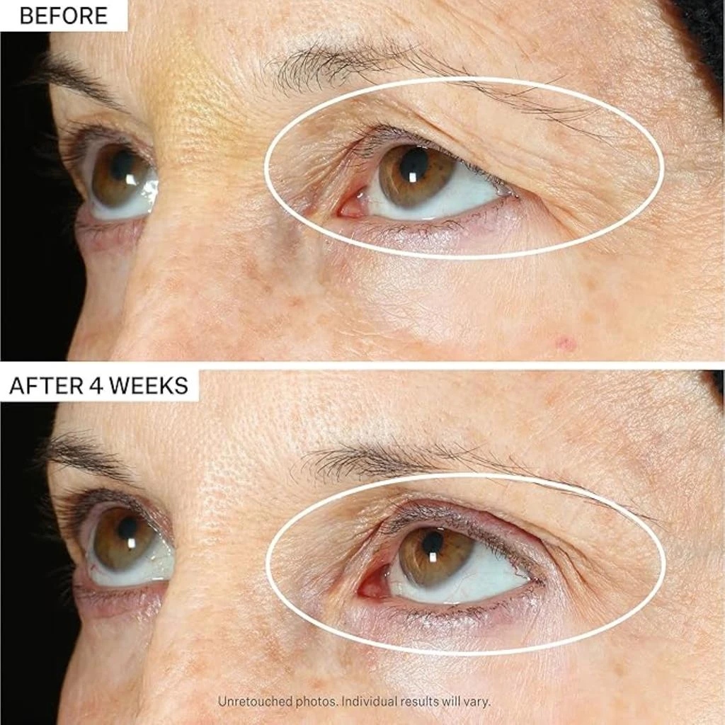 StriVectin StriVectin Peptight 360˚ Tightening Eye Serum 2