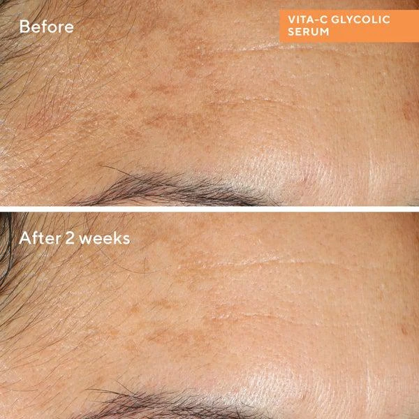 Murad Murad Vita-C Glycolic Brightening Serum 1 oz 2