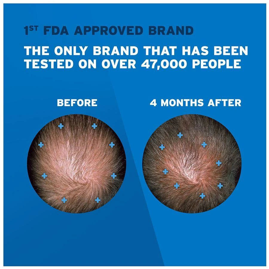 Rogaine 5% Minoxidil Foam for Hair Regrowth, Topical Treatment Unscented 7