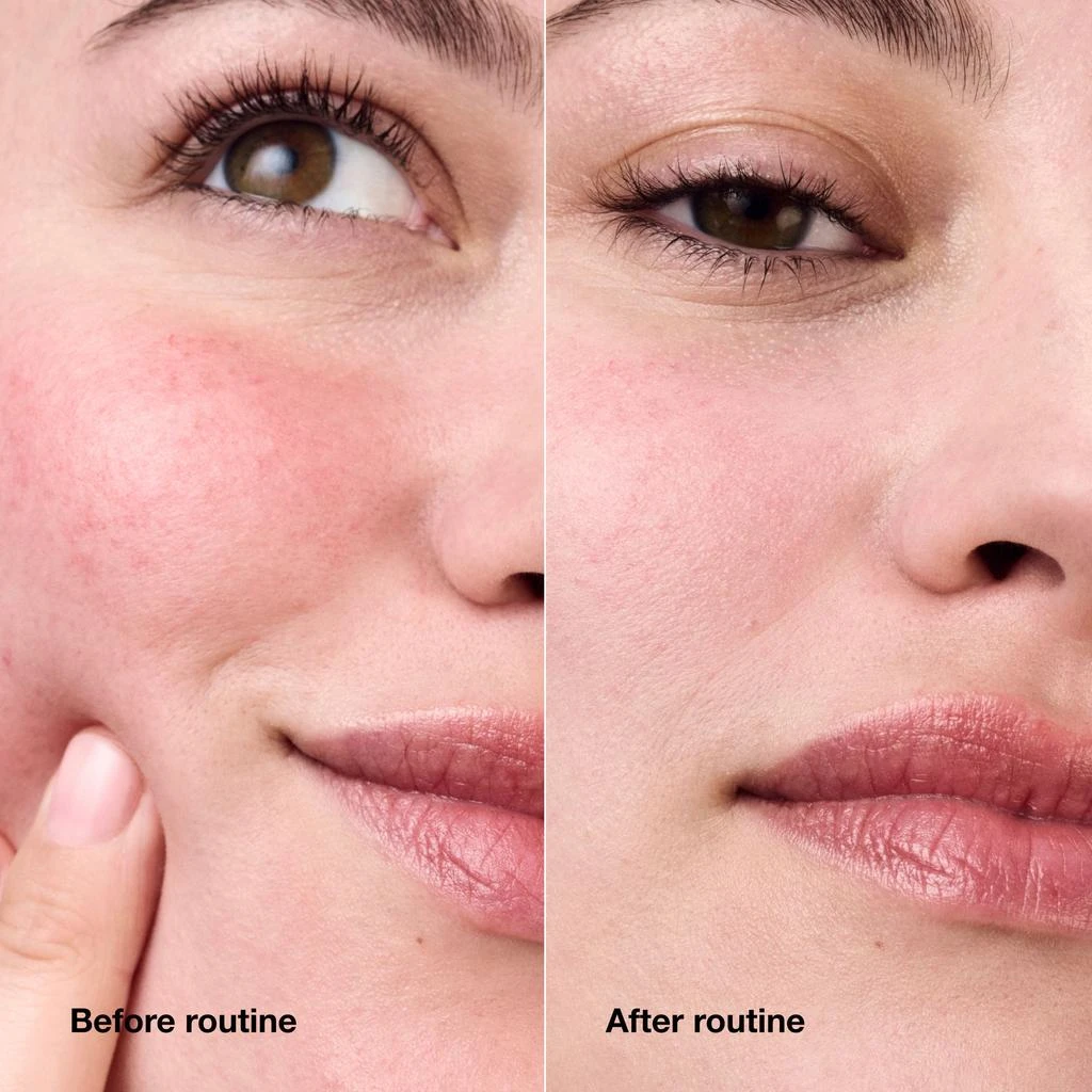 Clinique Redness Solutions Daily Relief Cream With Probiotic Technology 3