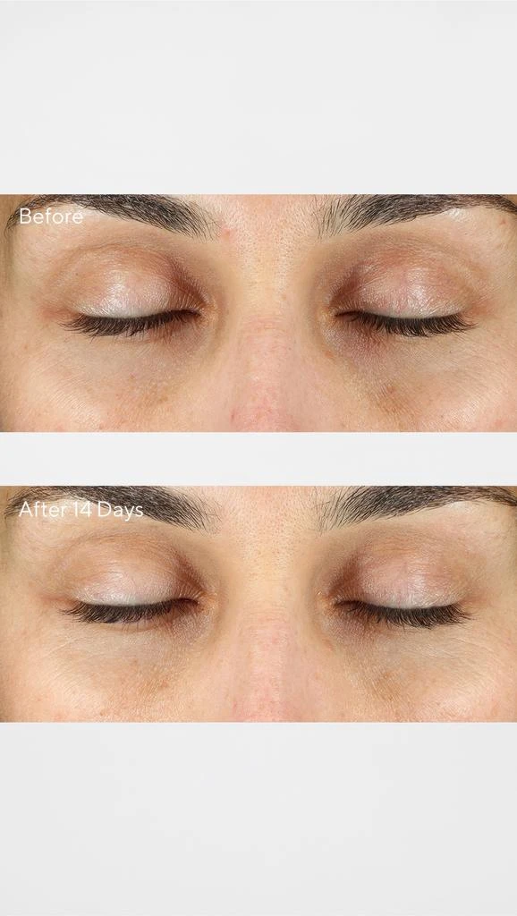 Murad Vita-C Eyes Dark Circle Corrector 3