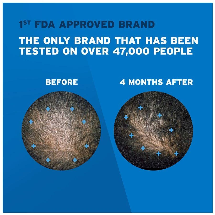 Rogaine 5% Minoxidil Foam for Hair Regrowth, Topical Treatment Unscented 9