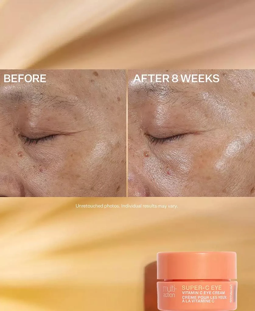 StriVectin 3-Pc. Multi-Action Brighten & Correct Set 5