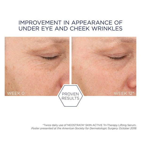 NeoStrata NEOSTRATA Skin Active Tri-Therapy Lifting Serum with Hyaluronic Acid 30ml 2