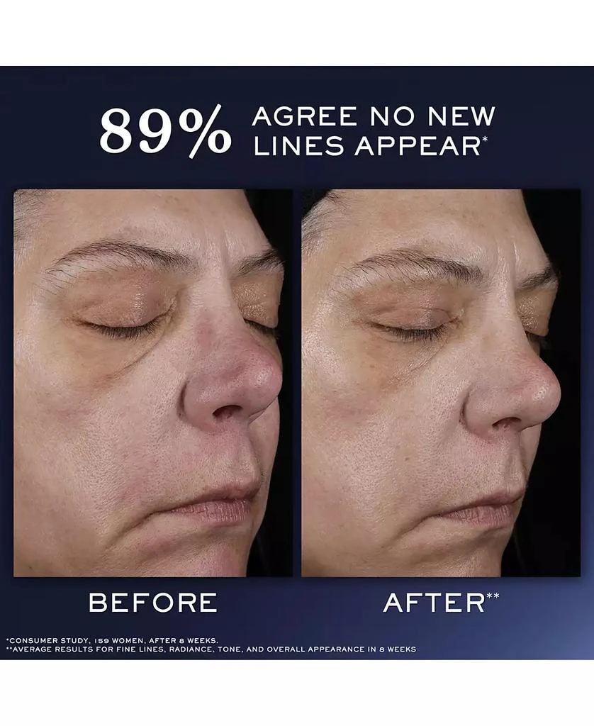 Lancôme 4-Pc. Rénergie Starter Kit Set 7