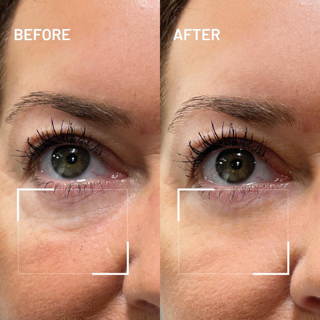 Dr. Brandt Skincare BYE BYE DARK CIRCLES EYE DUO