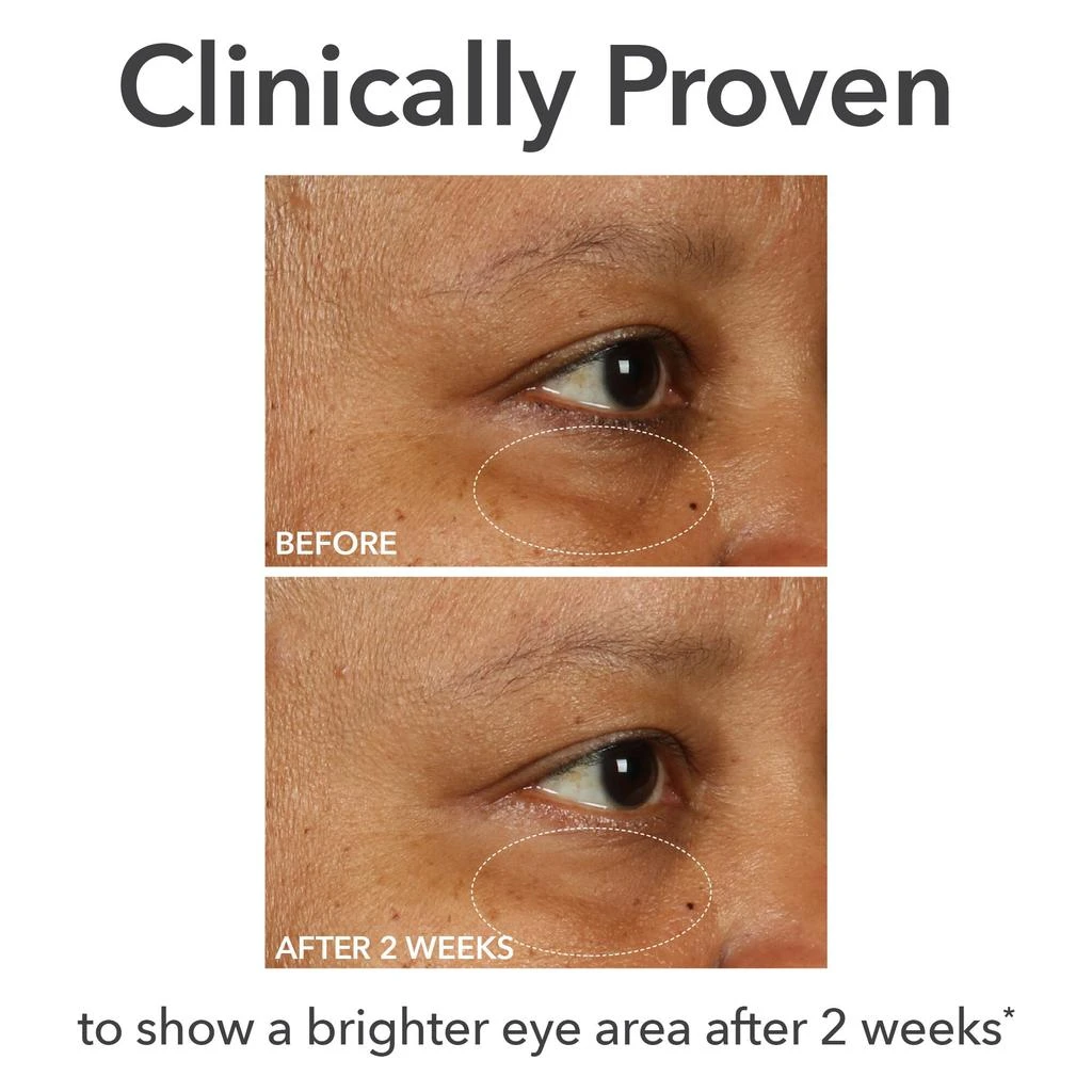 Dr. Dennis Gross Dr Dennis Gross Skincare DermInfusions Fill + Repair Eye Cream 15ml 4