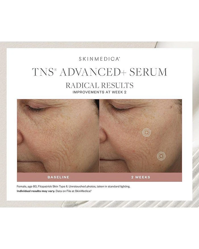 SkinMedica The Favorites Collection Skincare Set 8