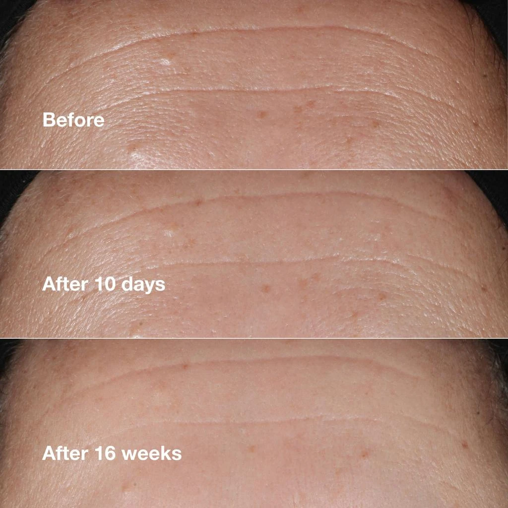 Clinique Smart Clinical Repair Wrinkle Correcting Serum 5