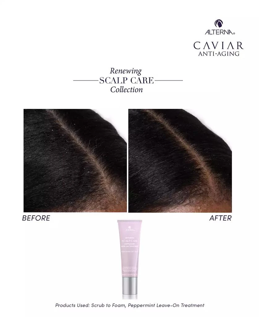 ALTERNA Renewing Scalp Care Peppermint Leave-On Treatment, 2.5 oz. 3