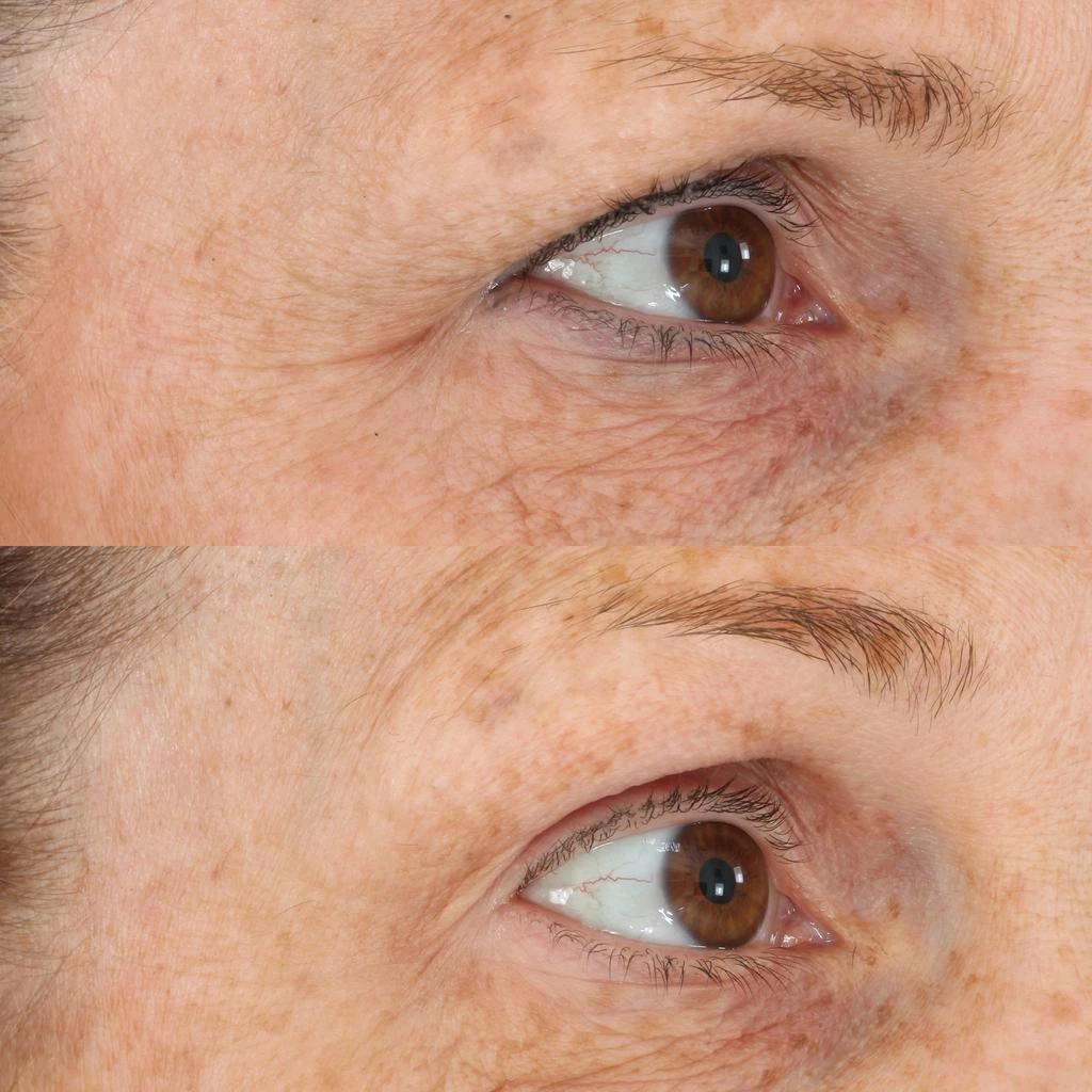 Perricone MD Perricone MD Essential Fx Acyl-Glutathione Eyelid Lift Serum 5
