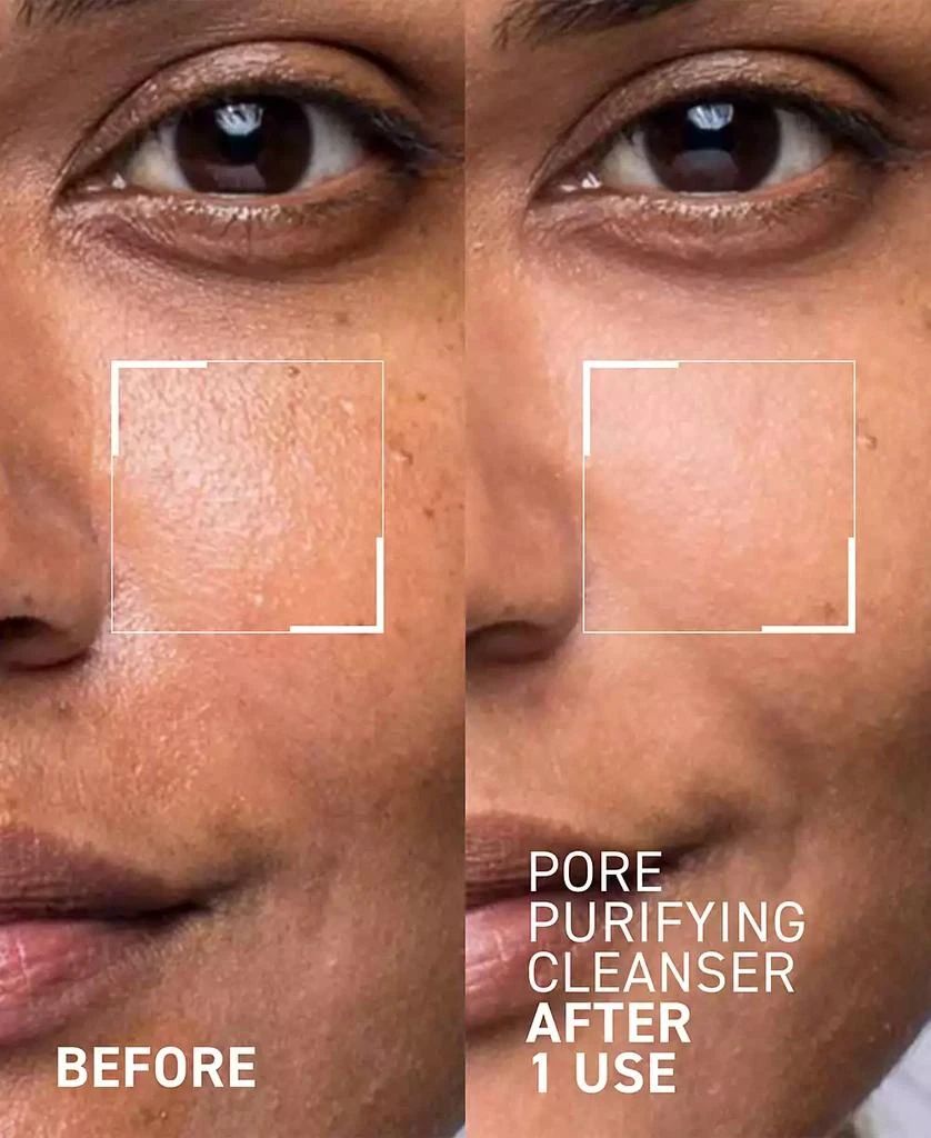 Dr. Brandt Skincare Pores No More Pore Purifying Cleanser 3