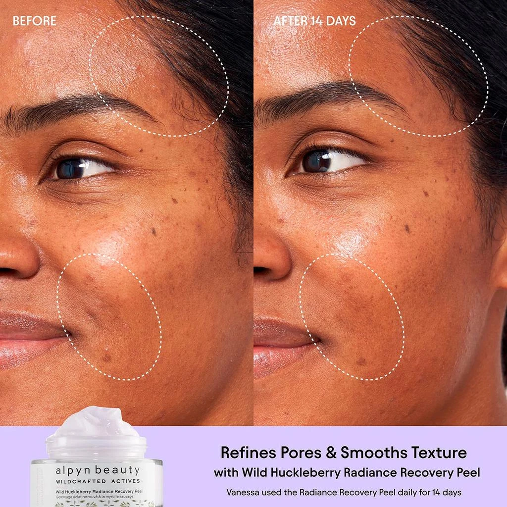 Alpyn Beauty Wild Huckleberry Radiance Recovery Peel 4