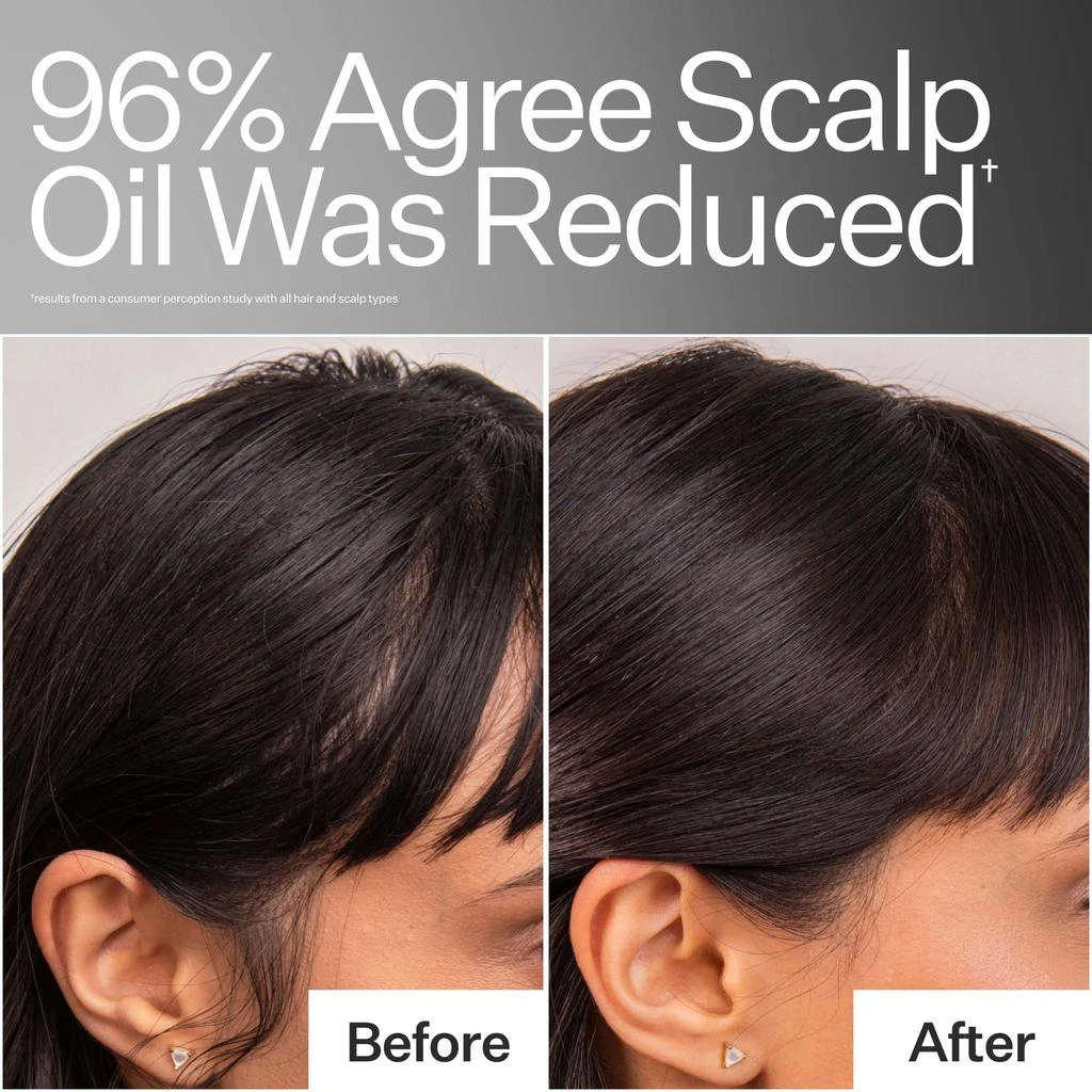 Act+Acre Act+Acre 4% Niacinamide Oily Scalp Serum 2.2 oz 3