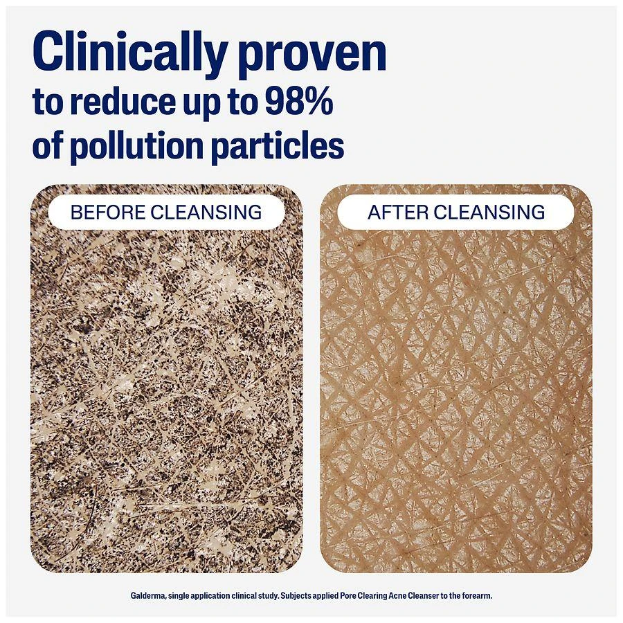 Cetaphil Clear Pore Clearing Acne Cleanser Unscented 8
