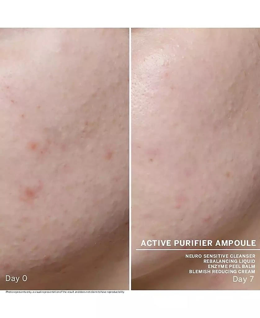 BABOR Active Purifier Ampoule Concentrates 4