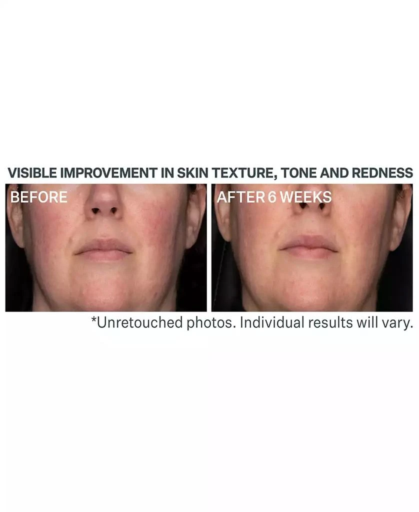 StriVectin Advanced Retinol Daily Repair Moisturizer SPF 30 3